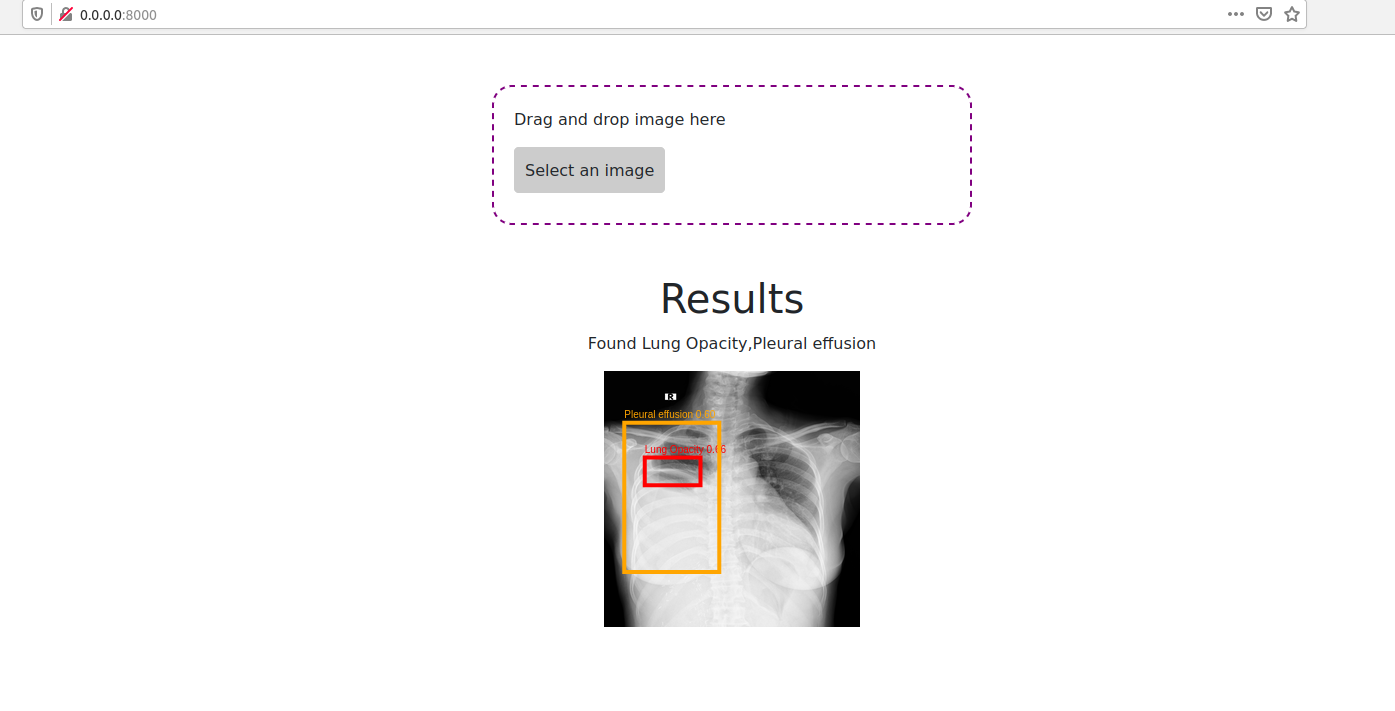 Xray detection demo